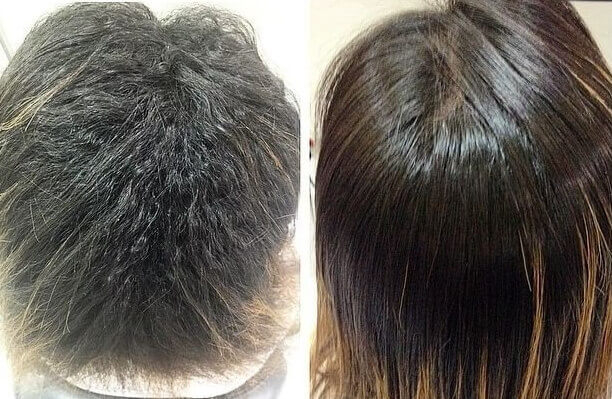 Resultado Antes e Depois Exo Hair